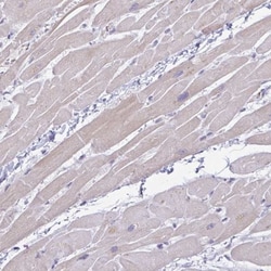 PLCD4 Antibody, Novus Biologicals:Antibodies:Primary Antibodies
