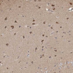 PLCL3 Antibody, Novus Biologicals:Antibodies:Primary Antibodies