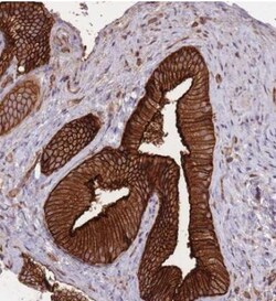 PLD1 Antibody, Novus Biologicals 0.1mL; Unlabeled:Antibodies, Polyclonal