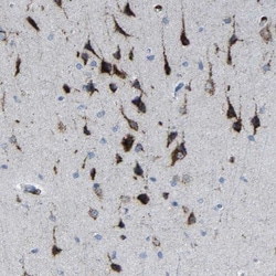 PLD3/Phospholipase D3 Antibody, Novus Biologicals:Antibodies:Primary Antibodies