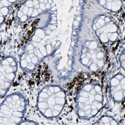 PLD3/Phospholipase D3 Antibody, Novus Biologicals:Antibodies:Primary Antibodies