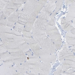 PLD3/Phospholipase D3 Antibody, Novus Biologicals:Antibodies:Primary Antibodies