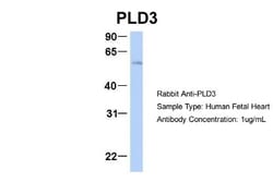 PLD3/Phospholipase D3 Antibody, Novus Biologicals 100 &mu;L | Buy Online | Novus Biologicals | Fisher Scientific