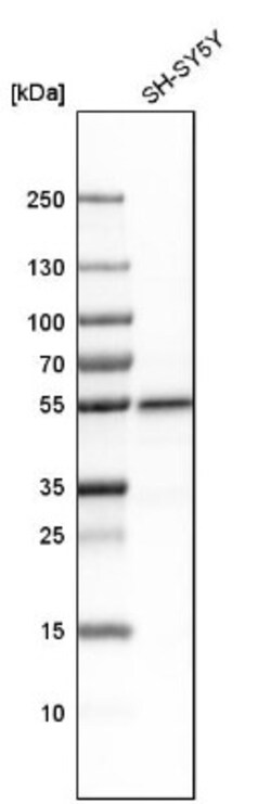 PLD3/Phospholipase D3 Antibody, Novus Biologicals:Antibodies:Primary Antibodies