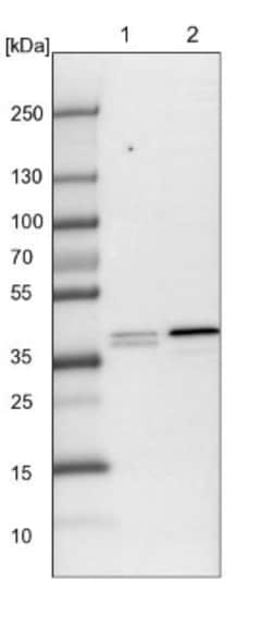 PLEKHA3 Antibody, Novus Biologicals 0.1mL; Unlabeled:Antibodies, Polyclonal