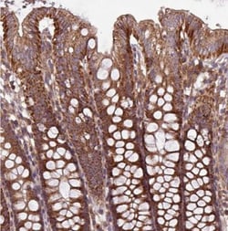 PLEKHD1 Antibody, Novus Biologicals 0.1mL; Unlabeled:Antibodies, Polyclonal