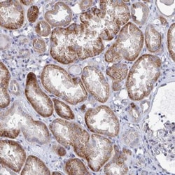 PLEKHG7 Antibody, Novus Biologicals:Antibodies:Primary Antibodies