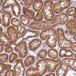 PLEKHM1 Antibody, Novus Biologicals 0.1 mL | Buy Online | Novus Biologicals | Fisher Scientific