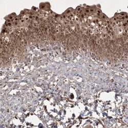 PLEKHM2 Antibody, Novus Biologicals 25 &mu;L; Unlabeled:Antibodies, Polyclonal