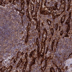 PLEKHO2 Antibody, Novus Biologicals:Antibodies:Primary Antibodies