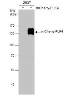 PLK4 Antibody, Novus Biologicals 0.1mL; Unlabeled:Antibodies, Polyclonal