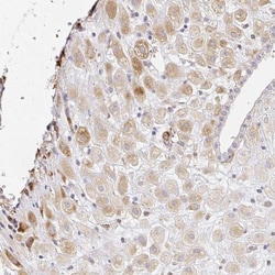 PLOD1 Antibody, Novus Biologicals:Antibodies:Primary Antibodies