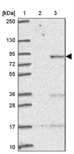 PLOD1 Antibody, Novus Biologicals:Antibodies:Primary Antibodies