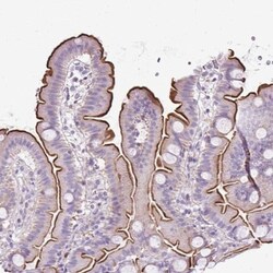 PLS1 Antibody, Novus Biologicals:Antibodies:Primary Antibodies