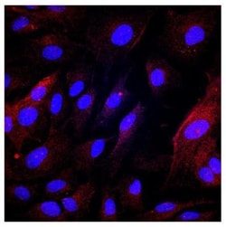 PLVAP Antibody, Novus Biologicals 0.1 mL | Buy Online | Novus Biologicals | Fisher Scientific