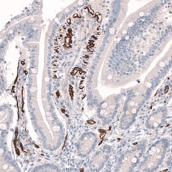 PLVAP Antibody, Novus Biologicals:Antibodies:Primary Antibodies