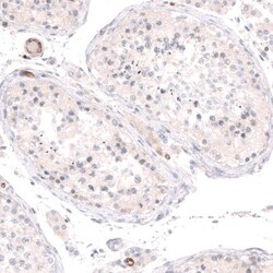 PLVAP Antibody, Novus Biologicals:Antibodies:Primary Antibodies