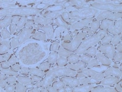 PLVAP Antibody, Novus Biologicals:Antibodies:Primary Antibodies