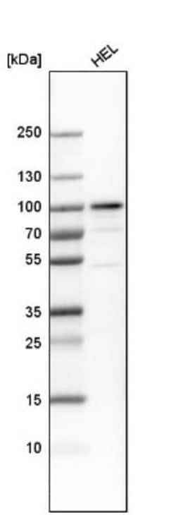 PLZF Antibody, Novus Biologicals 25ul | Buy Online | Novus Biologicals | Fisher Scientific