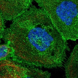 PMCA4 Antibody, Novus Biologicals 0.1mL; Unlabeled:Antibodies, Polyclonal