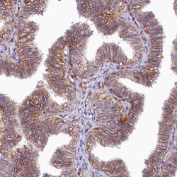 PMCA4 Antibody, Novus Biologicals 0.1mL; Unlabeled:Antibodies, Polyclonal