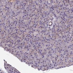 PMCA4 Antibody, Novus Biologicals 0.1mL; Unlabeled:Antibodies, Polyclonal