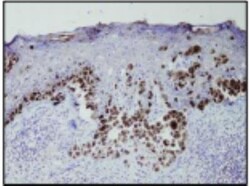 Rabbit anti-PMEL17/SILV, Clone: P14-V, Novus Biologicals:Antibodies:Primary
