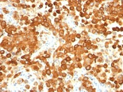 PMEL17/SILV Antibody (HMB45 + PMEL/783), Novus Biologicals 0.2mg; Unlabeled:Antibodies,