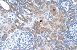 PMEL17/SILV Antibody, Novus Biologicals 0.1mg; Unlabeled:Antibodies, Polyclonal