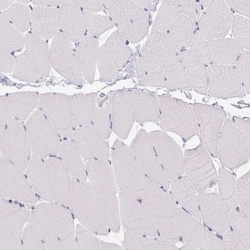 PMEL17/SILV Antibody, Novus Biologicals 0.1 mL | Buy Online | Novus Biologicals | Fisher Scientific