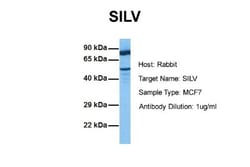 PMEL17/SILV Antibody, Novus Biologicals 0.1mg; Unlabeled:Antibodies, Polyclonal