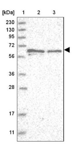 PMEL17/SILV Antibody, Novus Biologicals 0.1 mL | Buy Online | Novus Biologicals | Fisher Scientific
