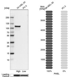 PMEL17/SILV Antibody, Novus Biologicals 0.1 mL | Buy Online | Novus Biologicals | Fisher Scientific