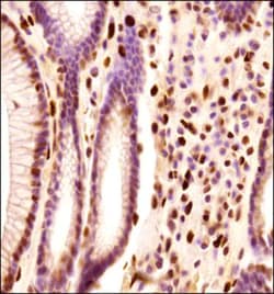 PML Protein Antibody - BSA Free, Novus Biologicals:Antibodies:Primary Antibodies