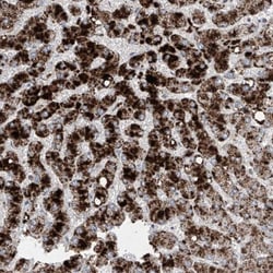 PMP70 Antibody, Novus Biologicals:Antibodies:Primary Antibodies