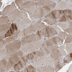 PMP70 Antibody, Novus Biologicals:Antibodies:Primary Antibodies