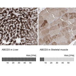 PMP70 Antibody, Novus Biologicals:Antibodies:Primary Antibodies