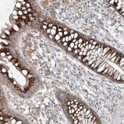 PMP70 Antibody, Novus Biologicals 25 &mu;L, Unlabeled:Antibodies, Polyclonal