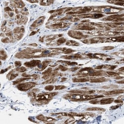 PMPCA Antibody, Novus Biologicals 0.1mL; Unlabeled:Antibodies, Polyclonal
