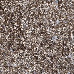 PMPCA Antibody, Novus Biologicals 0.1mL; Unlabeled:Antibodies, Polyclonal