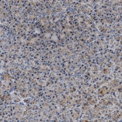 PMPCA Antibody, Novus Biologicals 0.1mL; Unlabeled:Antibodies, Polyclonal