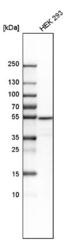 PMPCA Antibody, Novus Biologicals 0.1mL; Unlabeled:Antibodies, Polyclonal