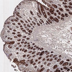 PMS2 Antibody (163C1251) - BSA Free, Novus Biologicals 0.1mg; Unlabeled:Antibodies,