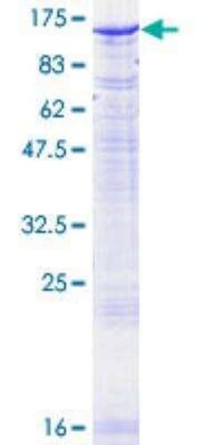 Novus Biologicals Recombinant Human PMS2 GST (N-Term) Protein 25 &mu;g | Buy Online | Novus Biologicals&trade; | Fisher Scientific