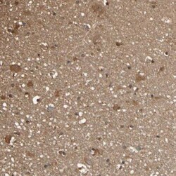PNCK Antibody, Novus Biologicals 25 &mu;L; Unlabeled:Antibodies, Polyclonal
