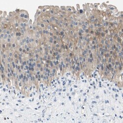 PNKD Antibody, Novus Biologicals:Antibodies:Primary Antibodies