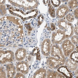 PNKD Antibody, Novus Biologicals:Antibodies:Primary Antibodies