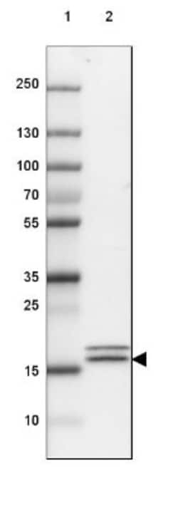 PNKD Antibody, Novus Biologicals:Antibodies:Primary Antibodies