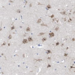 PNMA1 Antibody, Novus Biologicals 0.1mL; Unlabeled:Antibodies, Polyclonal