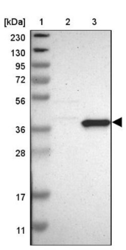 PNMA1 Antibody, Novus Biologicals 0.1mL; Unlabeled:Antibodies, Polyclonal